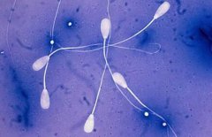 前列腺炎症对精子有什么样的影响？